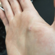 This is what Chris’s tumor looks like now.